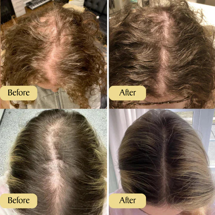 Magic Rabbit Fast Hair Growth Oil | Anti Dandruff 🔥 BUY 1 GET 1 FREE 🔥