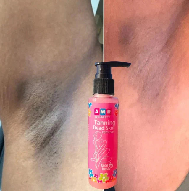 Removing Dead Skin Cells Reveal Smoother & Softer Skin (Buy 1 Get 1 Free)