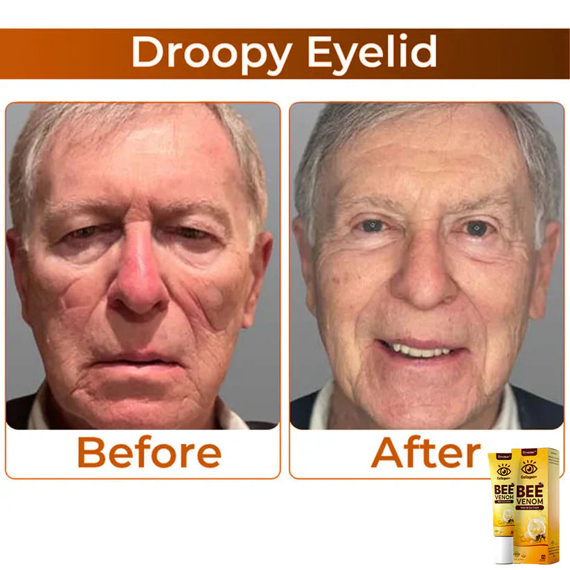 COLLAGEN+ BEE VENOM WAKE UP EYE CREAM (BUY 1 GET 1 FREE)