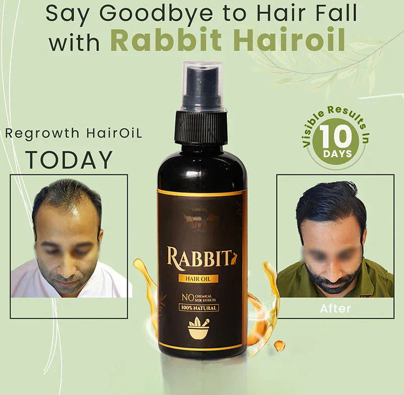 Magic Rabbit Fast Hair Growth Oil | Anti Dandruff 🔥 BUY 1 GET 1 FREE 🔥